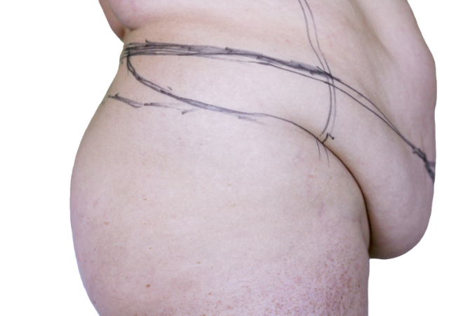 Image link